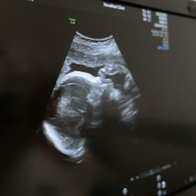 Jestli žena zažívá potrat třetího vymodleného dítěte, chci to vědět, říká porodní bába